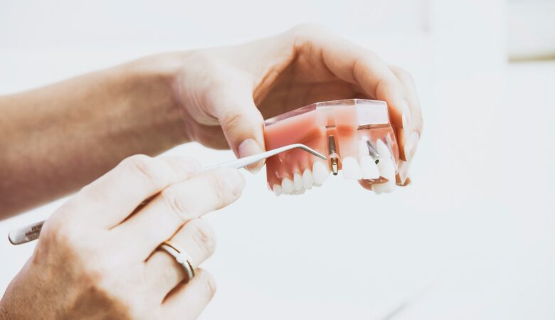 5 Reasons Why Dental Implants Are The Best Option For Replacing Missing Teeth